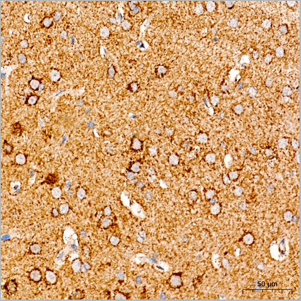 product-image-AAA28619_IHC3.jpg
