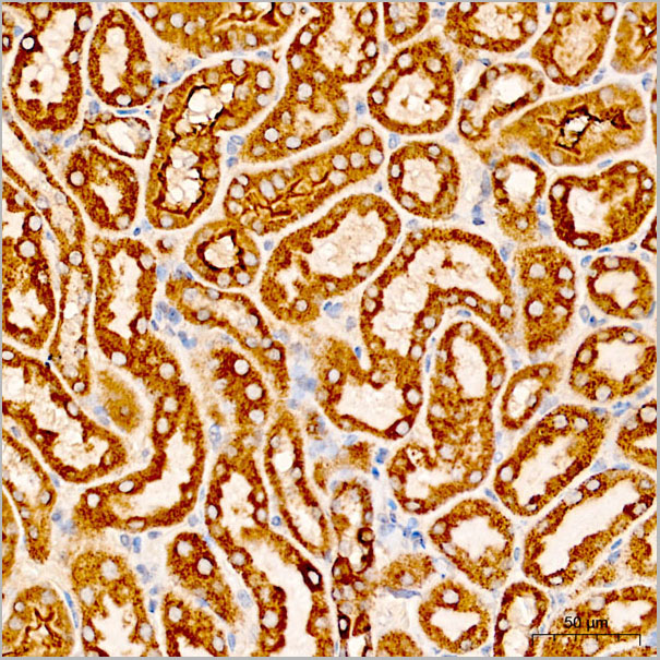 product-image-AAA28619_IHC5.jpg