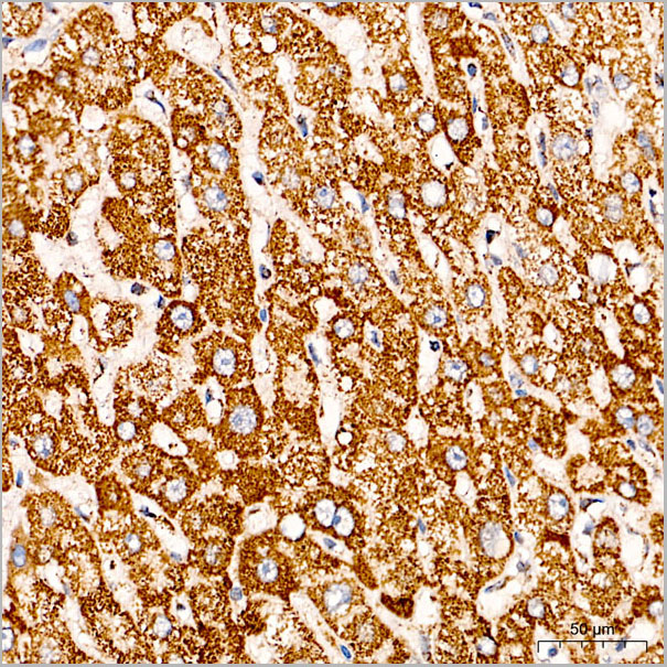 product-image-AAA28619_IHC6.jpg
