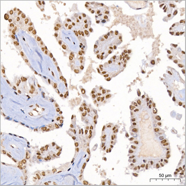 product-image-AAA28620_IHC2.jpg
