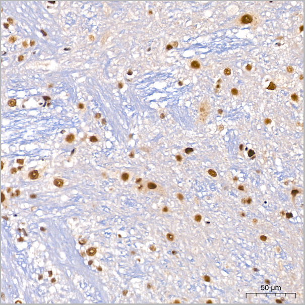 product-image-AAA28620_IHC3.jpg