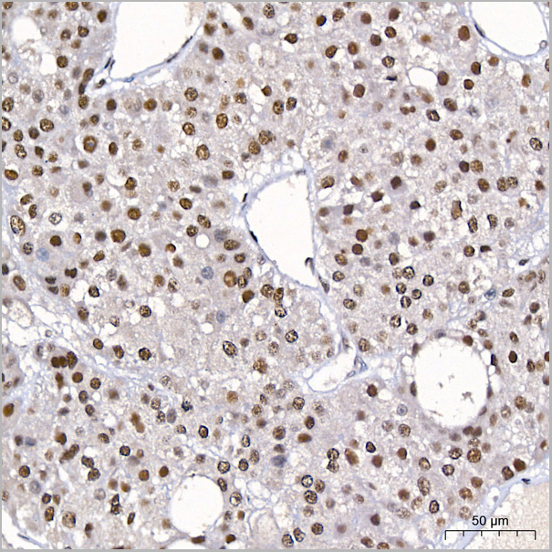 product-image-AAA28620_IHC5.jpg
