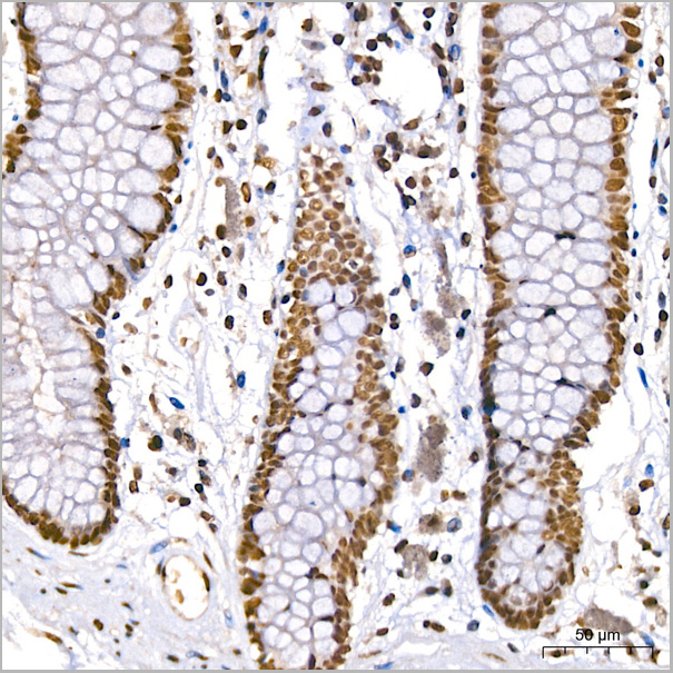 product-image-AAA28620_IHC6.jpg