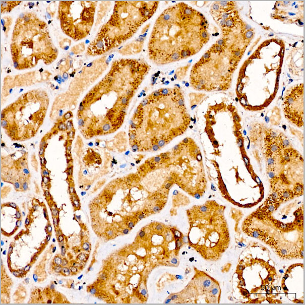 product-image-AAA28621_IHC3.jpg