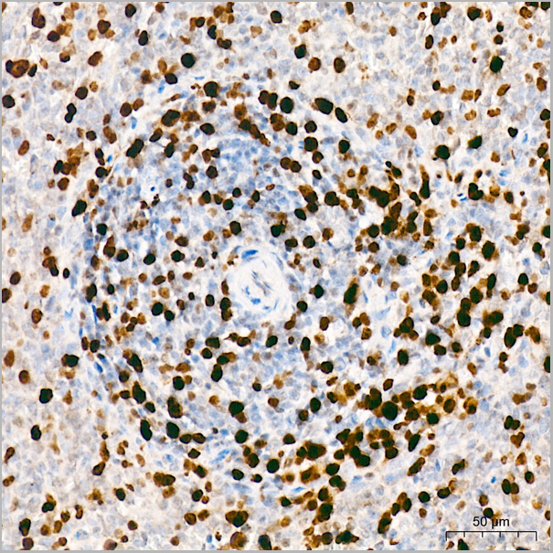 product-image-AAA28624_IHC.jpg
