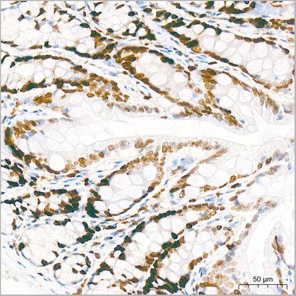 product-image-AAA28624_IHC2.jpg