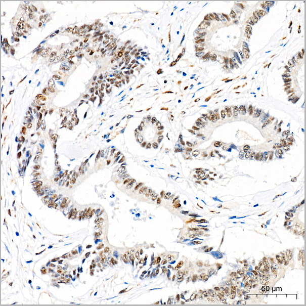 product-image-AAA28624_IHC3.jpg