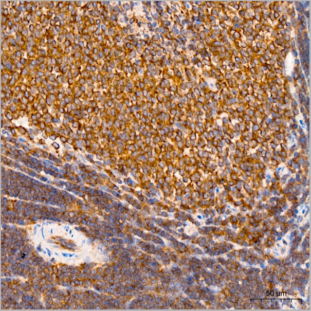 product-image-AAA28625_IHC2.jpg
