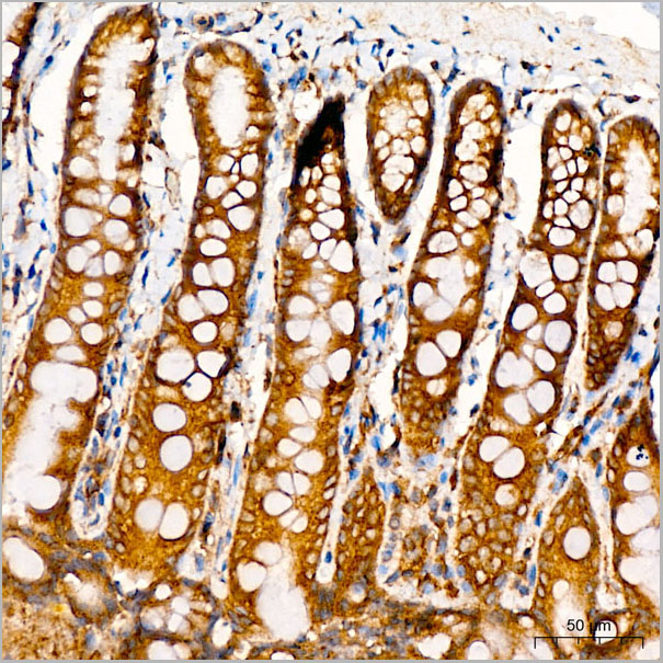 product-image-AAA28625_IHC3.jpg
