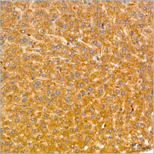 product-image-AAA28625_IHC4.jpg