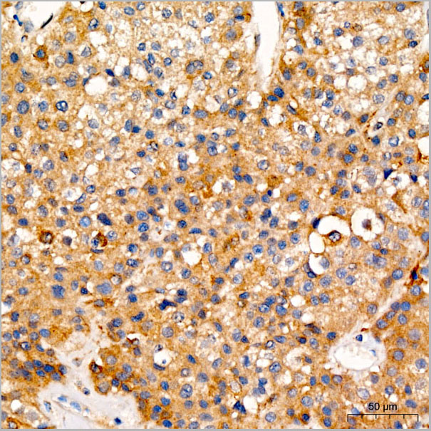 product-image-AAA28625_IHC5.jpg