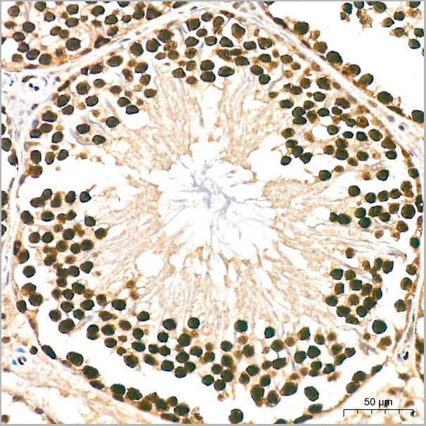 product-image-AAA28626_IHC3.jpg
