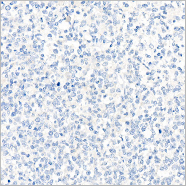 product-image-AAA28629_IHC.jpg