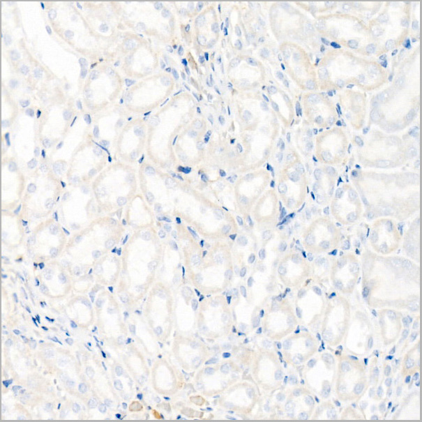 product-image-AAA28629_IHC2.jpg