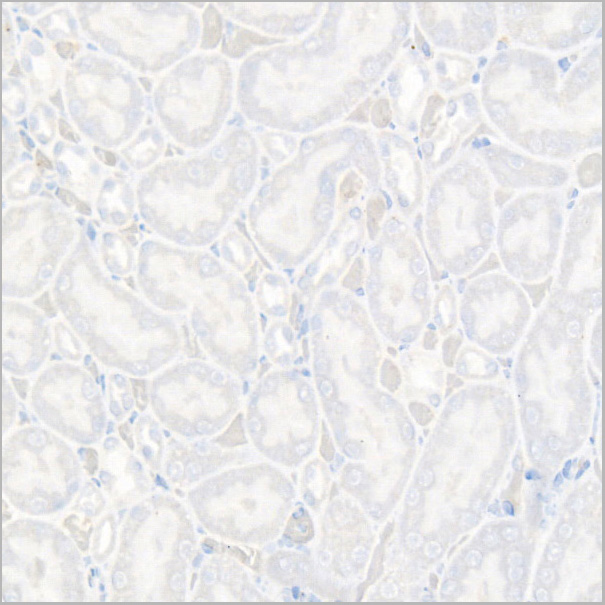 product-image-AAA28629_IHC3.jpg