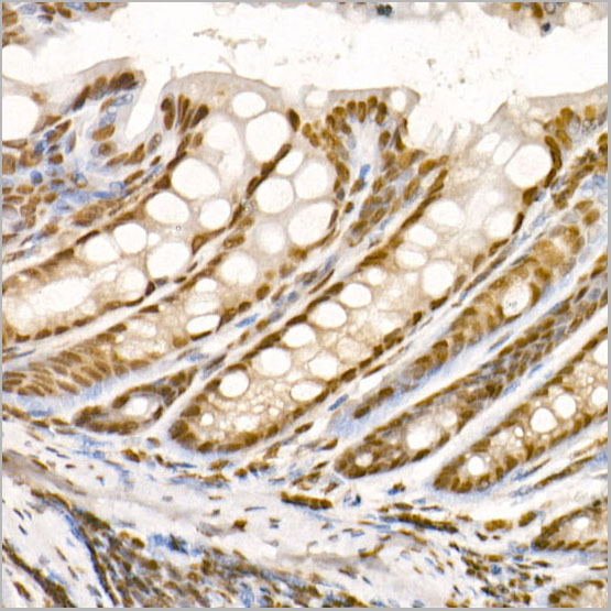 product-image-AAA28630_IHC5.jpg