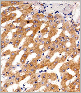 product-image-AAA28632_IHC.jpg