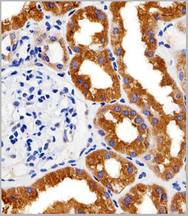 product-image-AAA28632_IHC2.jpg