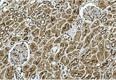 product-image-AAA28641_IHC.jpg
