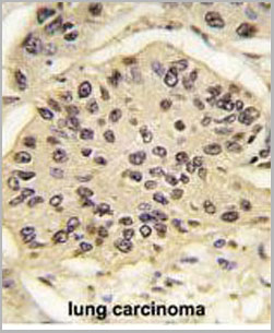 product-image-AAA28642_IHC5.jpg