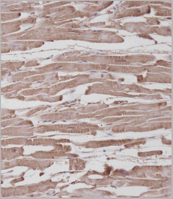 product-image-AAA28644_IHC3.jpg