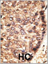 product-image-AAA28661_IHC2.jpg