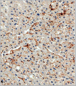 product-image-AAA28664_IHC2.jpg