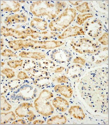 product-image-AAA28671_IHC.jpg