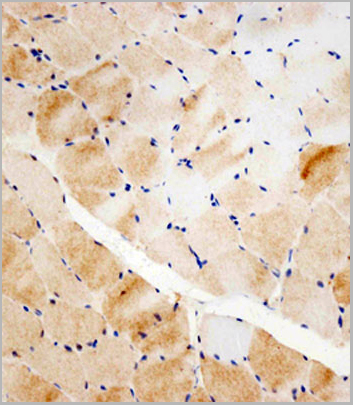 product-image-AAA28671_IHC2.jpg