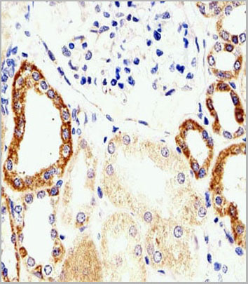 product-image-AAA28674_IHC17.jpg