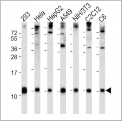 product-image-AAA28688_ELISA2.jpg
