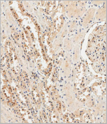 product-image-AAA28688_IHC5.jpg