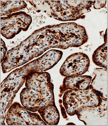 product-image-AAA28695_IHC6.jpg