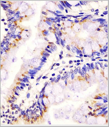 product-image-AAA28698_IHC.jpg