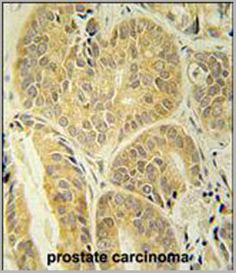 product-image-AAA28699_IHC2.jpg