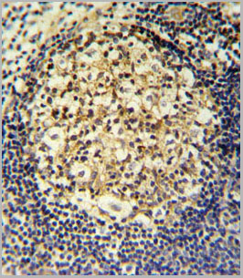 product-image-AAA28701_IHC6.jpg