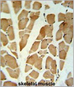 product-image-AAA28703_IHC6.jpg
