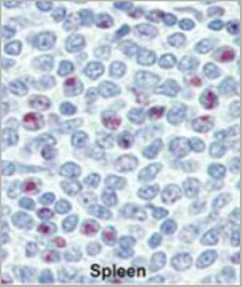 product-image-AAA28706_IHC3.jpg