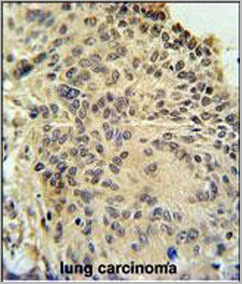 product-image-AAA28708_IHC2.jpg