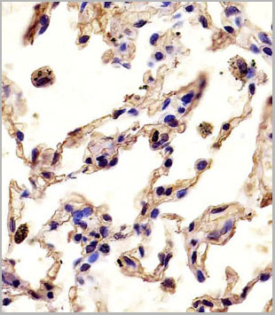 product-image-AAA28713_IHC.jpg