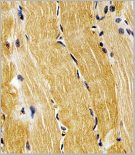 product-image-AAA28717_IHC2.jpg
