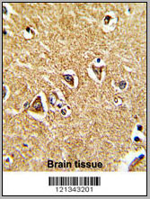 product-image-AAA28717_IHC7.jpg