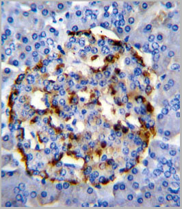 product-image-AAA28718_IHC2.jpg