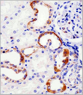 product-image-AAA28722_IHC2.jpg