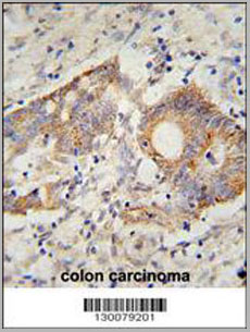 product-image-AAA28722_IHC5.jpg