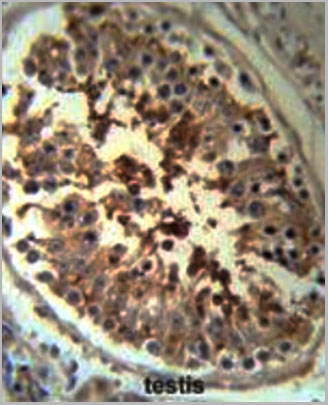 product-image-AAA28730_IHC2.jpg