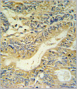 product-image-AAA28733_IHC2.jpg