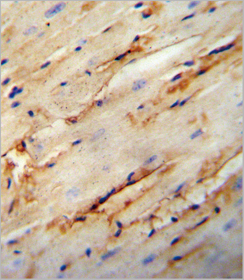 product-image-AAA28740_IHC3.jpg