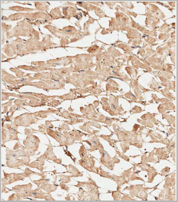 product-image-AAA28740_IHC6.jpg