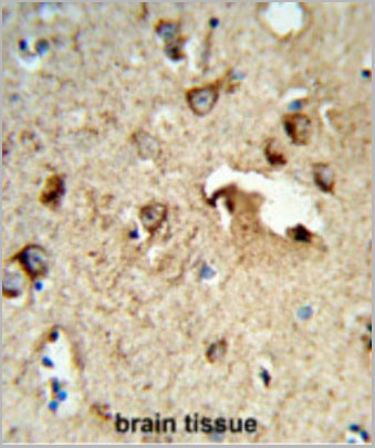 product-image-AAA28745_IHC2.jpg